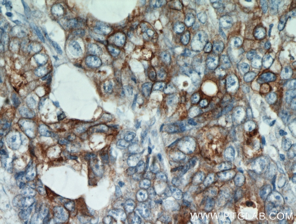 CEA Polyclonal antibody