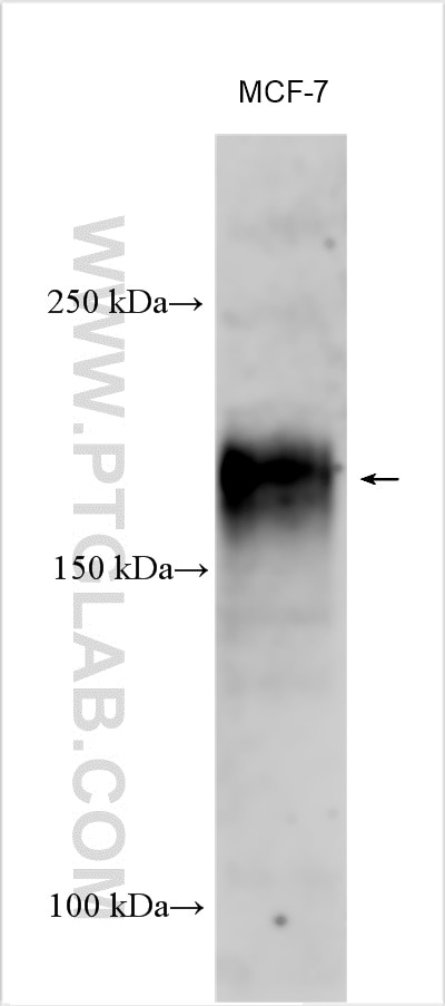 Western Blot (WB) analysis of MCF-7 cells using CEA Polyclonal antibody (10421-1-AP)