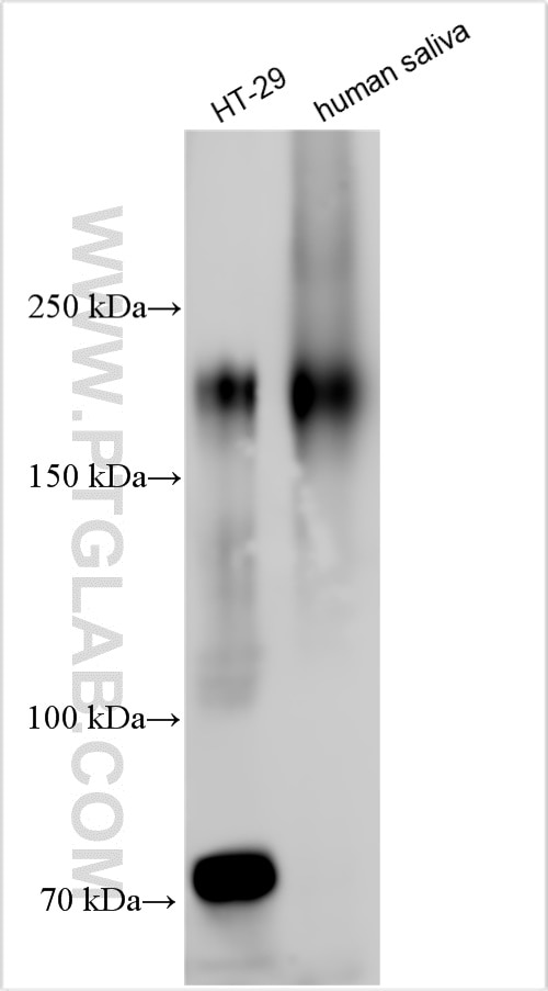 Western Blot (WB) analysis of various lysates using CEA Polyclonal antibody (10421-1-AP)