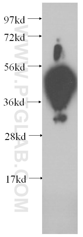 Western Blot (WB) analysis of human colon tissue using CEA Monoclonal antibody (60053-1-Ig)