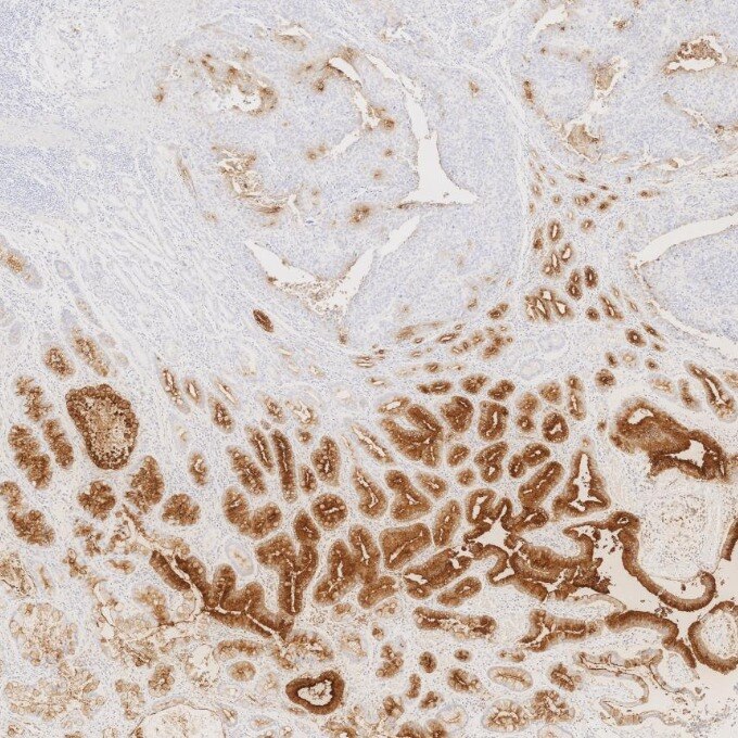 CEA/CD66e antibody (68377-1-Ig) | Proteintech
