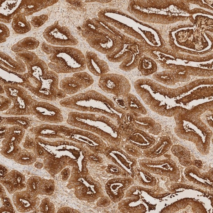 CEA/CD66e antibody (68377-1-Ig) | Proteintech
