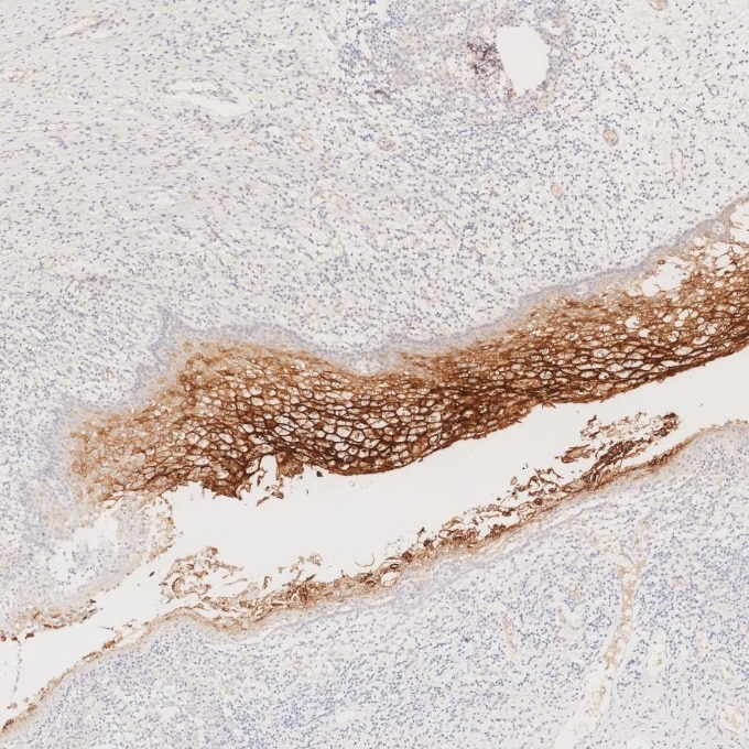 ズナです CEA/CD66e antibody (68377-1-Ig) | Proteintech