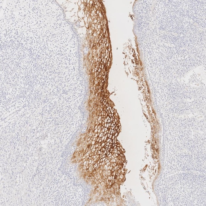 CEA/CD66e antibody (68377-1-Ig) | Proteintech