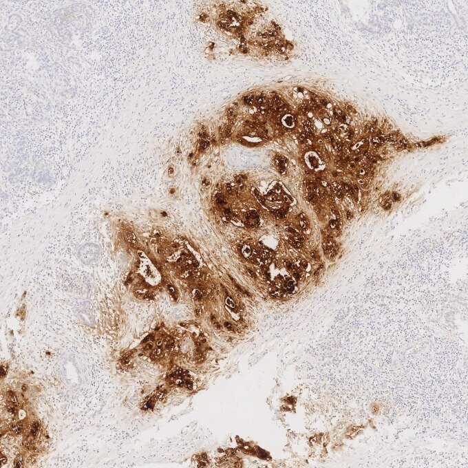 CEA/CD66e antibody (68377-1-Ig) | Proteintech