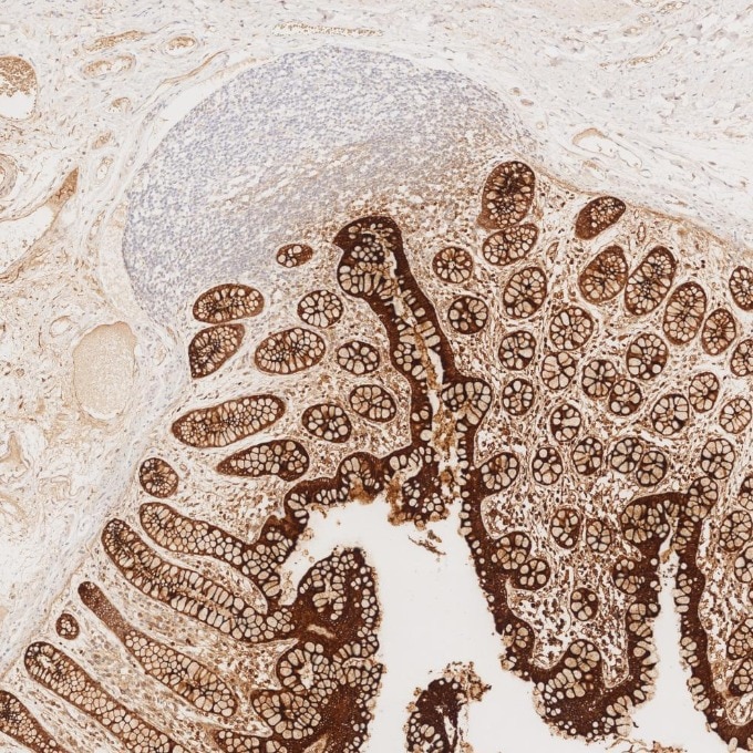 ズナです CEA/CD66e antibody (68377-1-Ig) | Proteintech