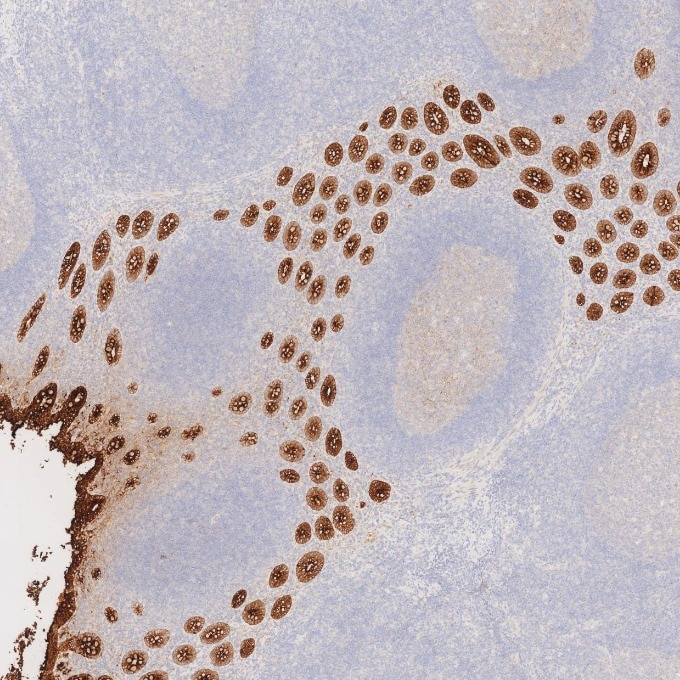 CEA/CD66e antibody (68377-1-Ig) | Proteintech