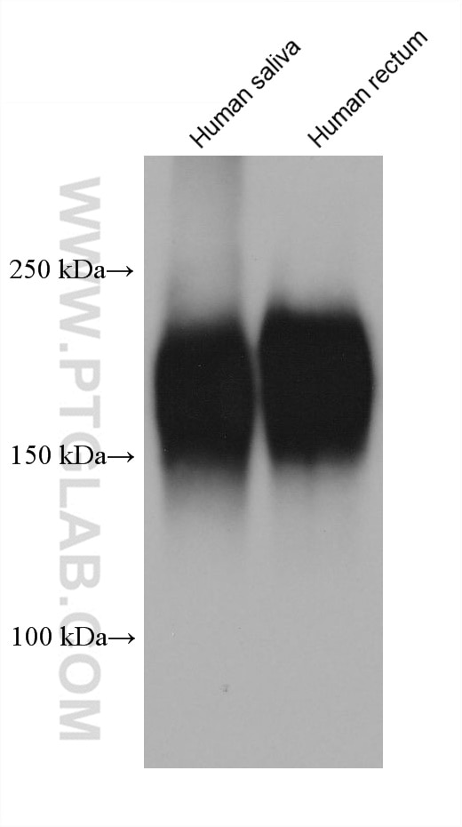 Western Blot (WB) analysis of various lysates using CEA/CD66e Monoclonal antibody (68377-1-Ig)