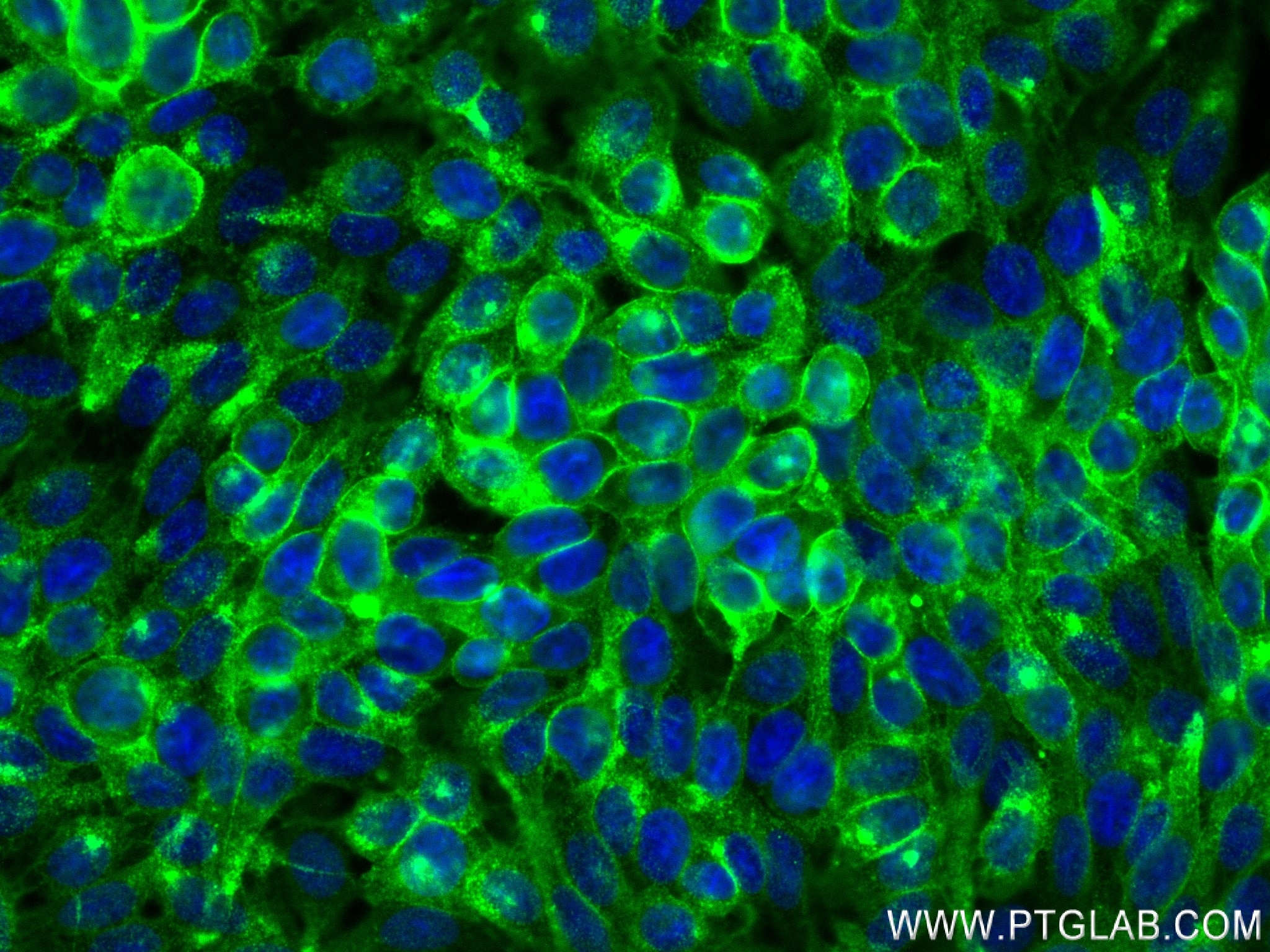 Immunofluorescence (IF) / fluorescent staining of HT-29 cells using CEA/CD66e Recombinant antibody (83653-5-RR)