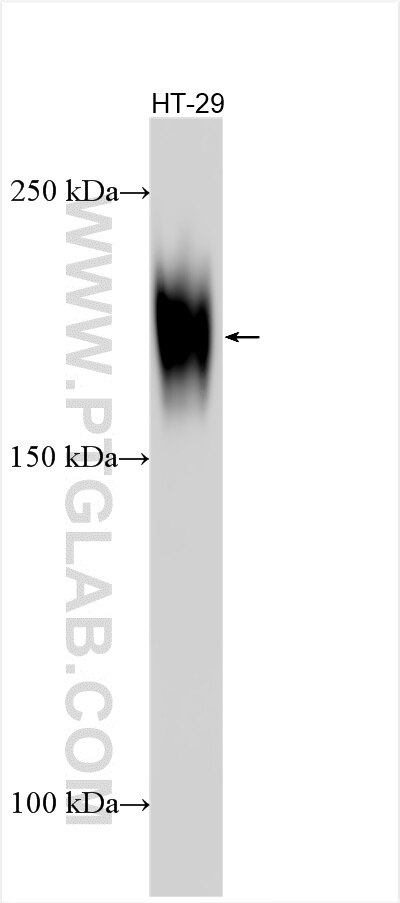 Western Blot (WB) analysis of various lysates using CEA/CD66e Polyclonal antibody (31519-1-AP)