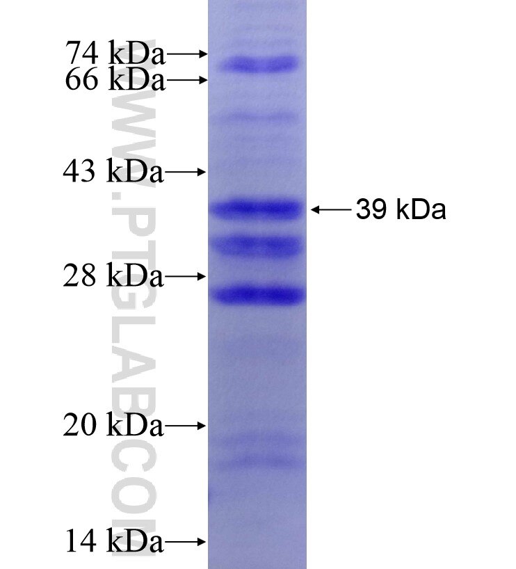 CEACAM5 fusion protein Ag16777 SDS-PAGE