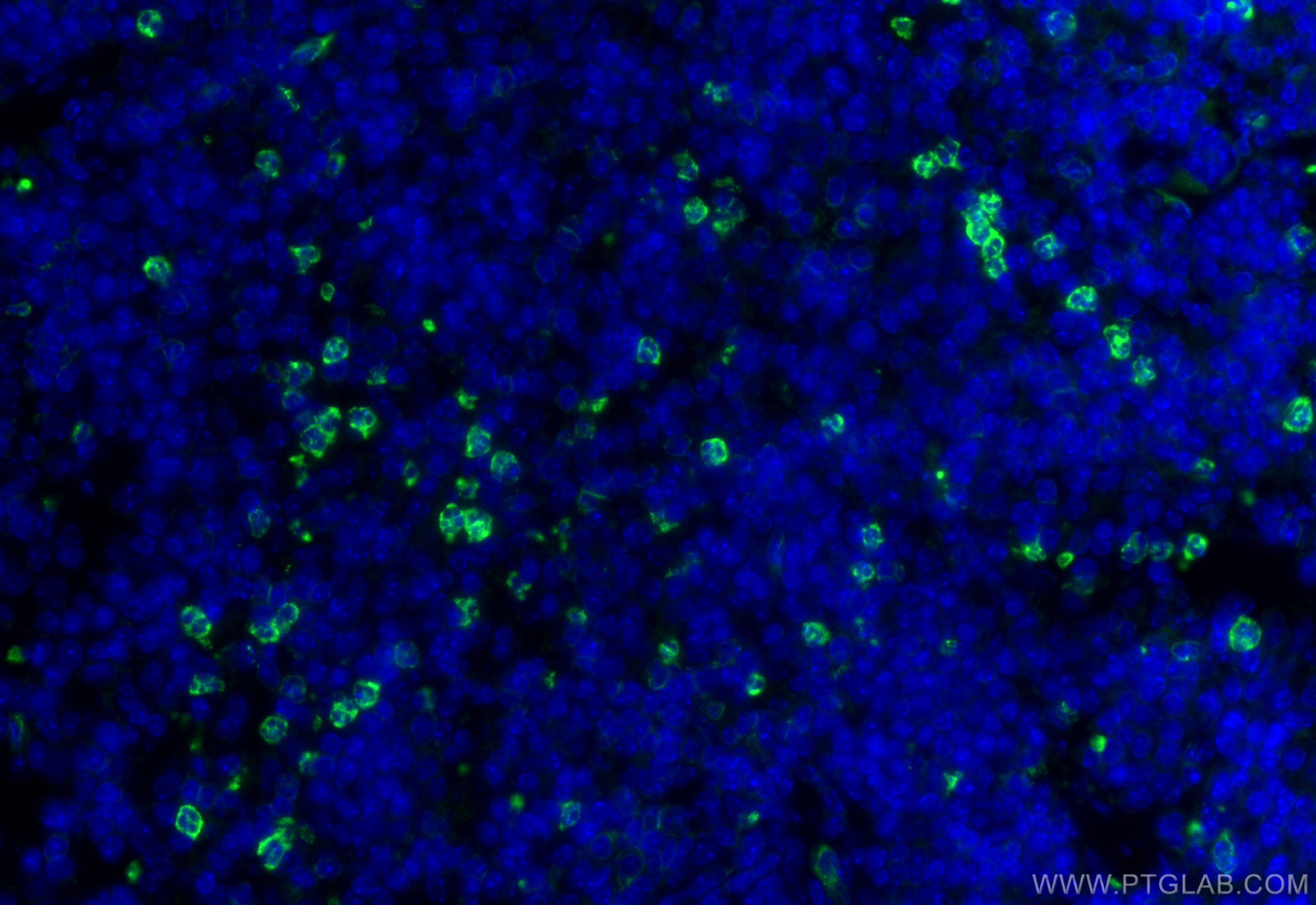 Immunofluorescence (IF) / fluorescent staining of mouse spleen tissue using CEACAM-1/CD66a Polyclonal antibody (32395-1-AP)