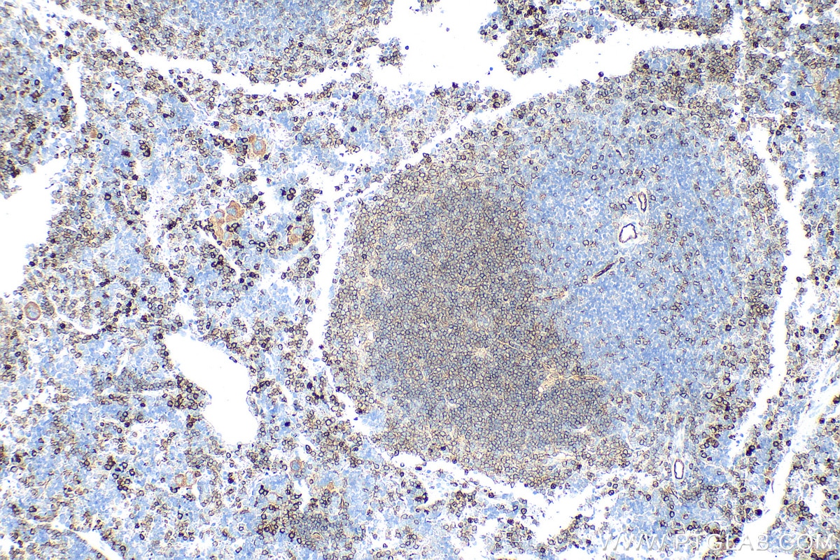 Immunohistochemistry (IHC) staining of mouse spleen tissue using CEACAM-1/CD66a Polyclonal antibody (32395-1-AP)
