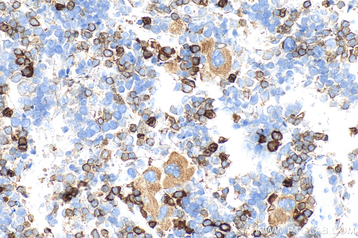 Immunohistochemistry (IHC) staining of mouse spleen tissue using CEACAM-1/CD66a Polyclonal antibody (32395-1-AP)