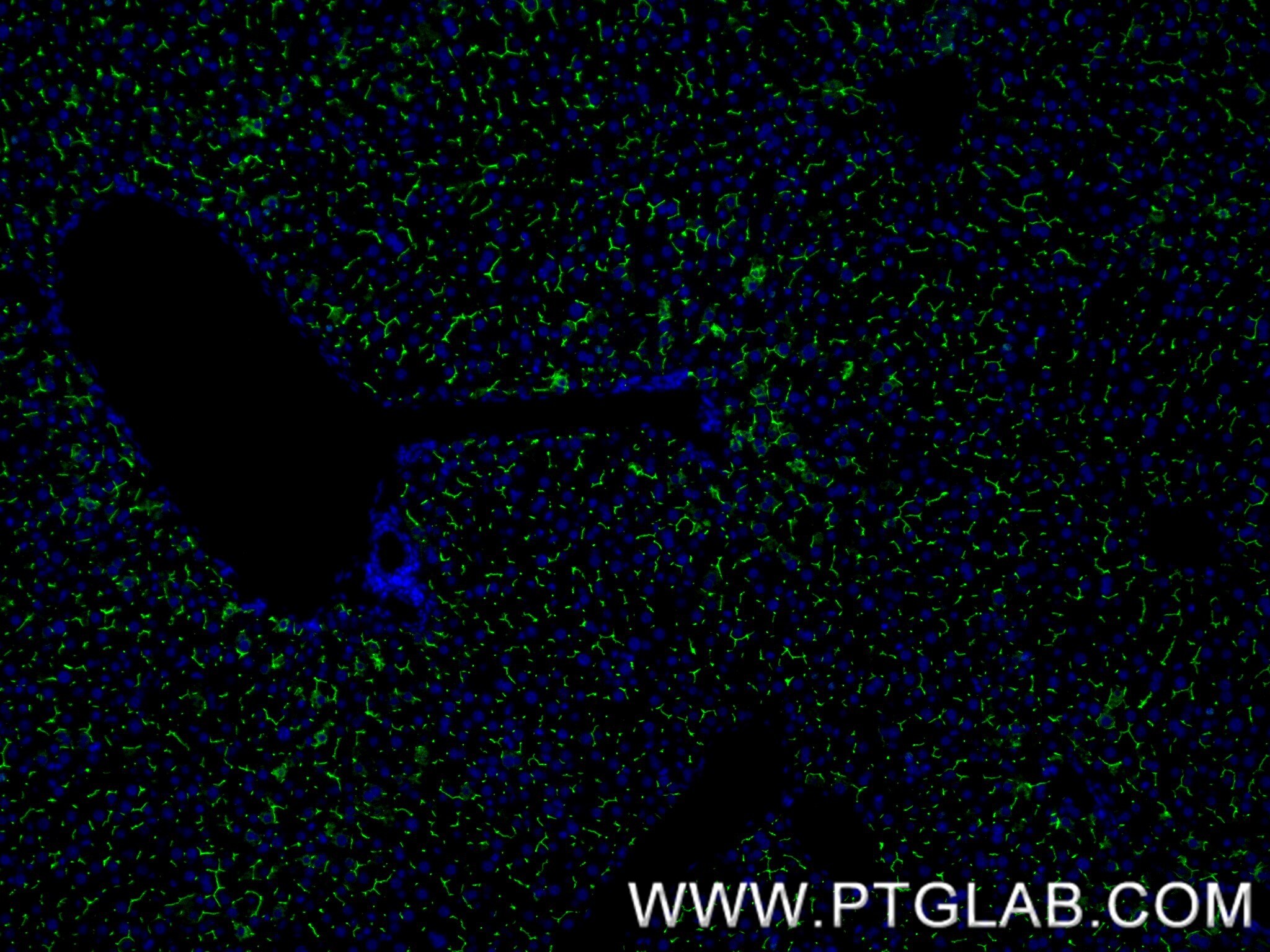 Immunofluorescence (IF) / fluorescent staining of mouse liver tissue using CEACAM1/CD66a Recombinant antibody (84409-4-RR)