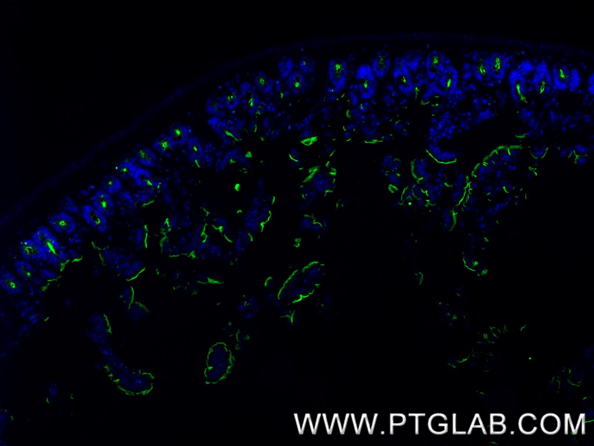 Immunofluorescence (IF) / fluorescent staining of mouse small intestine tissue using CEACAM1/CD66a Recombinant antibody (84409-4-RR)