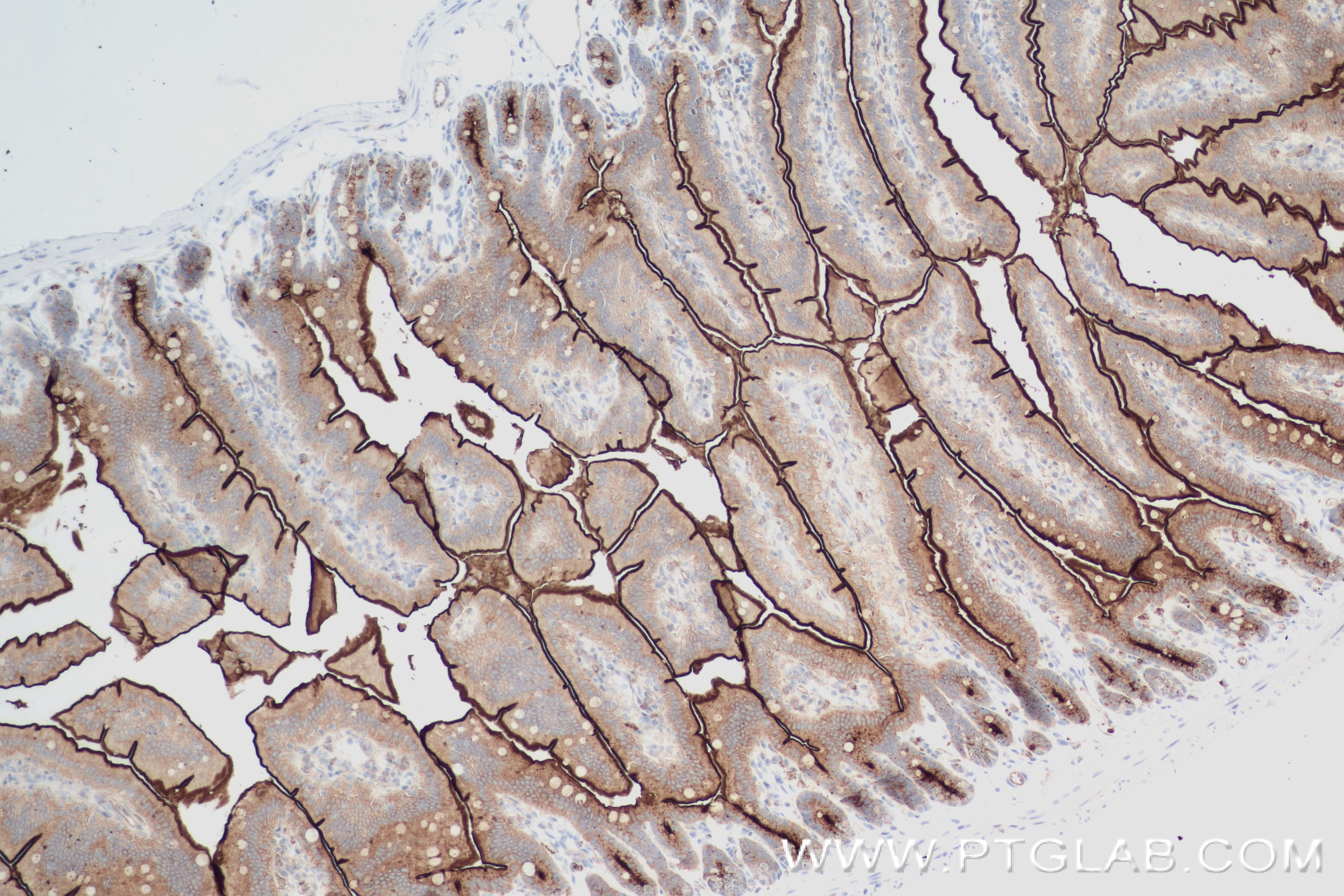 Immunohistochemistry (IHC) staining of mouse small intestine tissue using CEACAM1/CD66a Recombinant antibody (84409-4-RR)