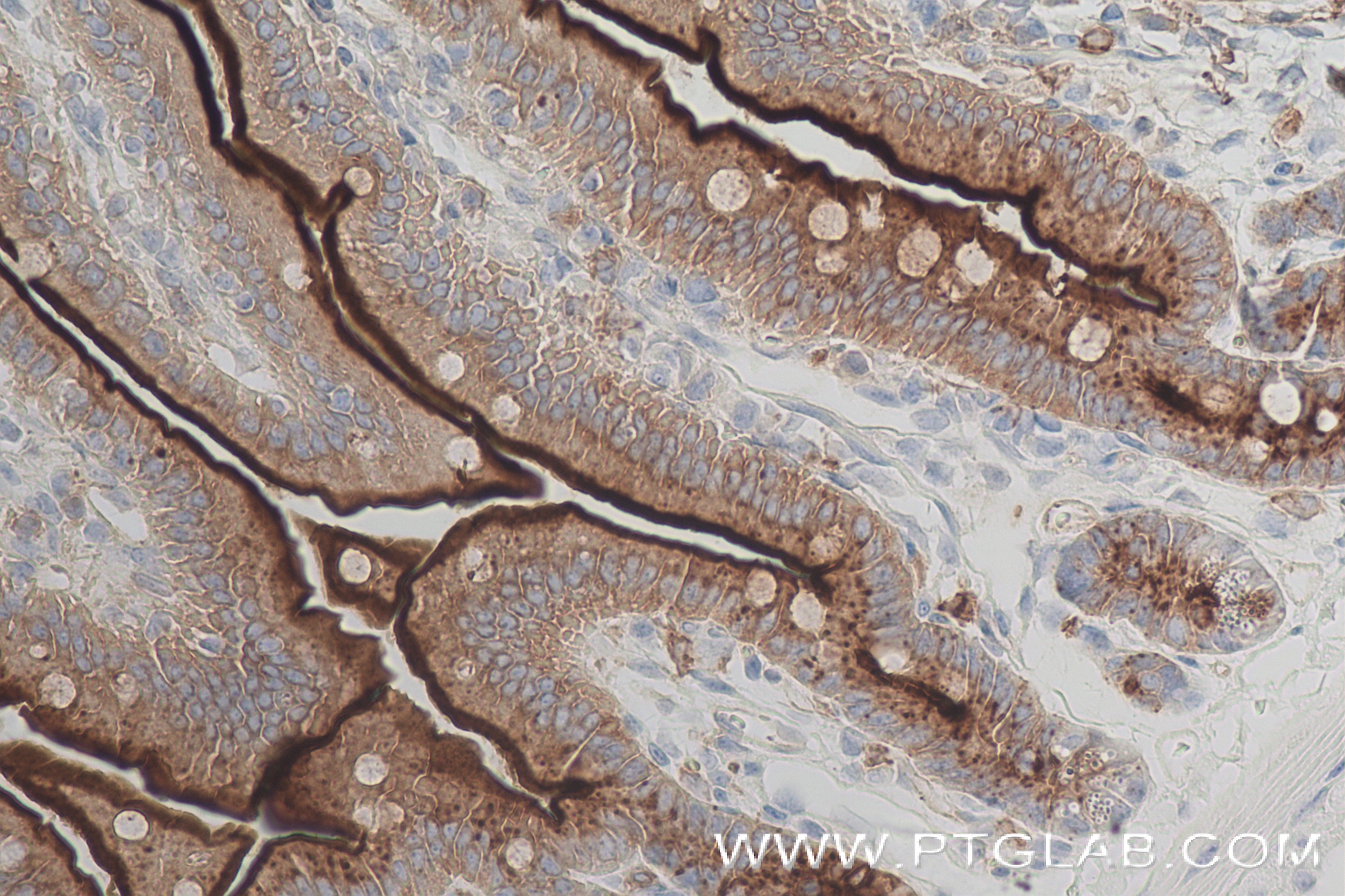 Immunohistochemistry (IHC) staining of mouse small intestine tissue using CEACAM1/CD66a Recombinant antibody (84409-4-RR)