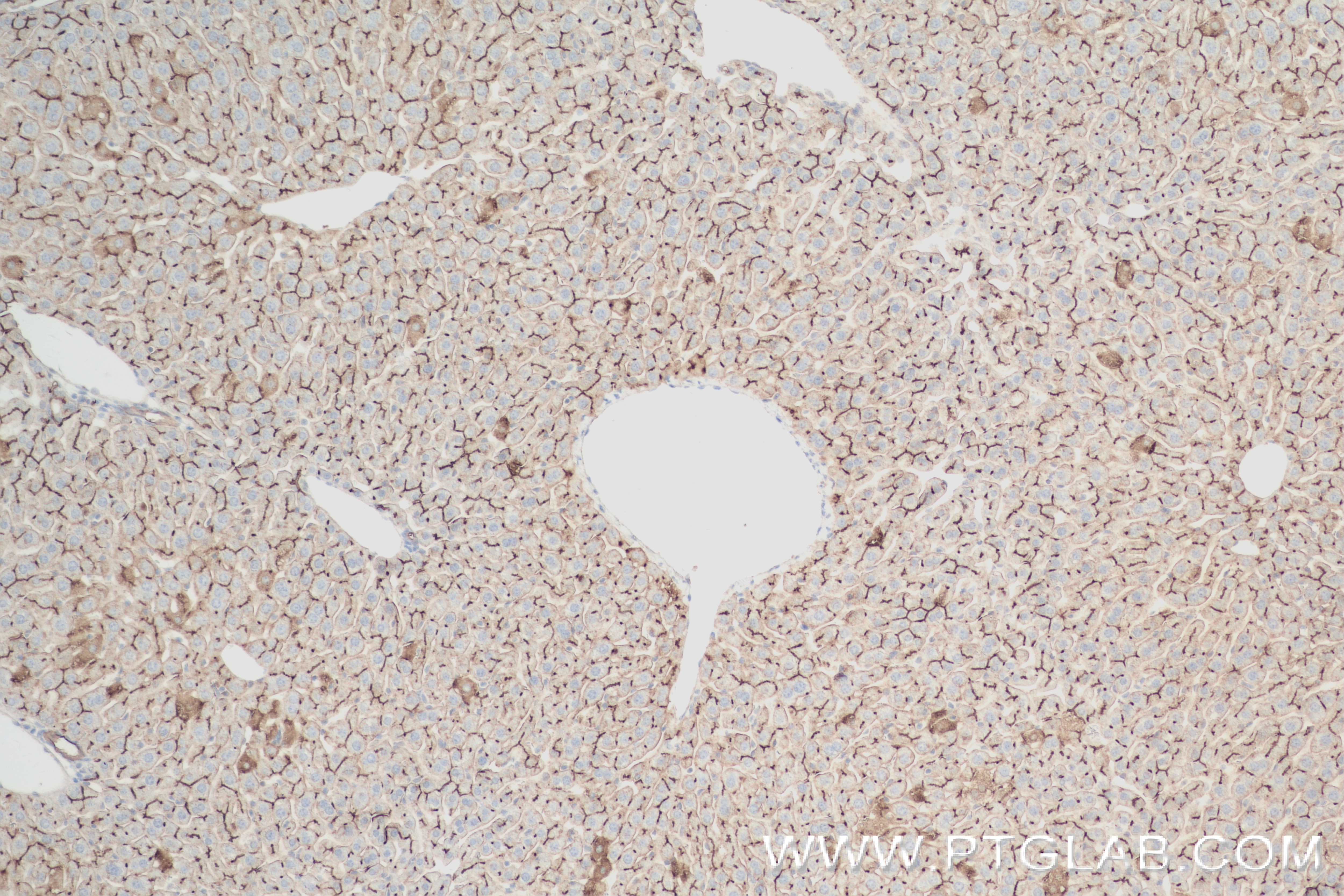 Immunohistochemistry (IHC) staining of mouse liver tissue using CEACAM1/CD66a Recombinant antibody (84409-4-RR)