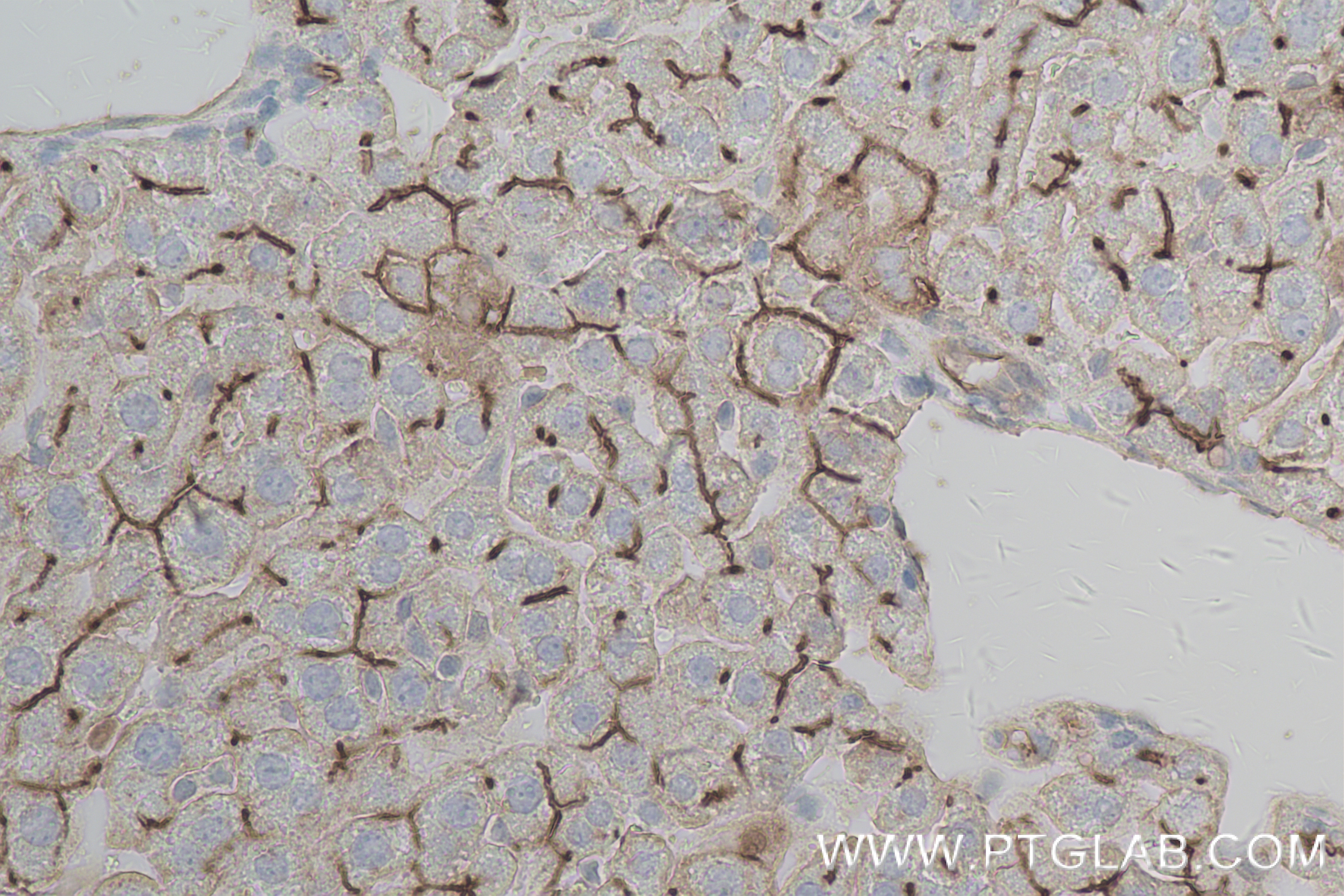 Immunohistochemistry (IHC) staining of mouse liver tissue using CEACAM1/CD66a Recombinant antibody (84409-4-RR)