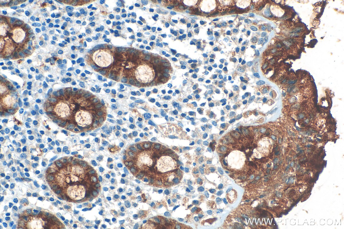 Immunohistochemistry (IHC) staining of human colon tissue using CEACAM1/CD66a Polyclonal antibody (30347-1-AP)