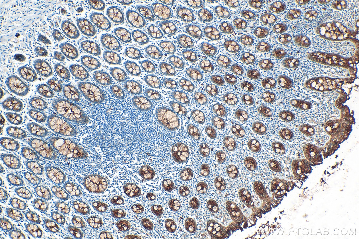 Immunohistochemistry (IHC) staining of human colon tissue using CEACAM1/CD66a Polyclonal antibody (30347-1-AP)