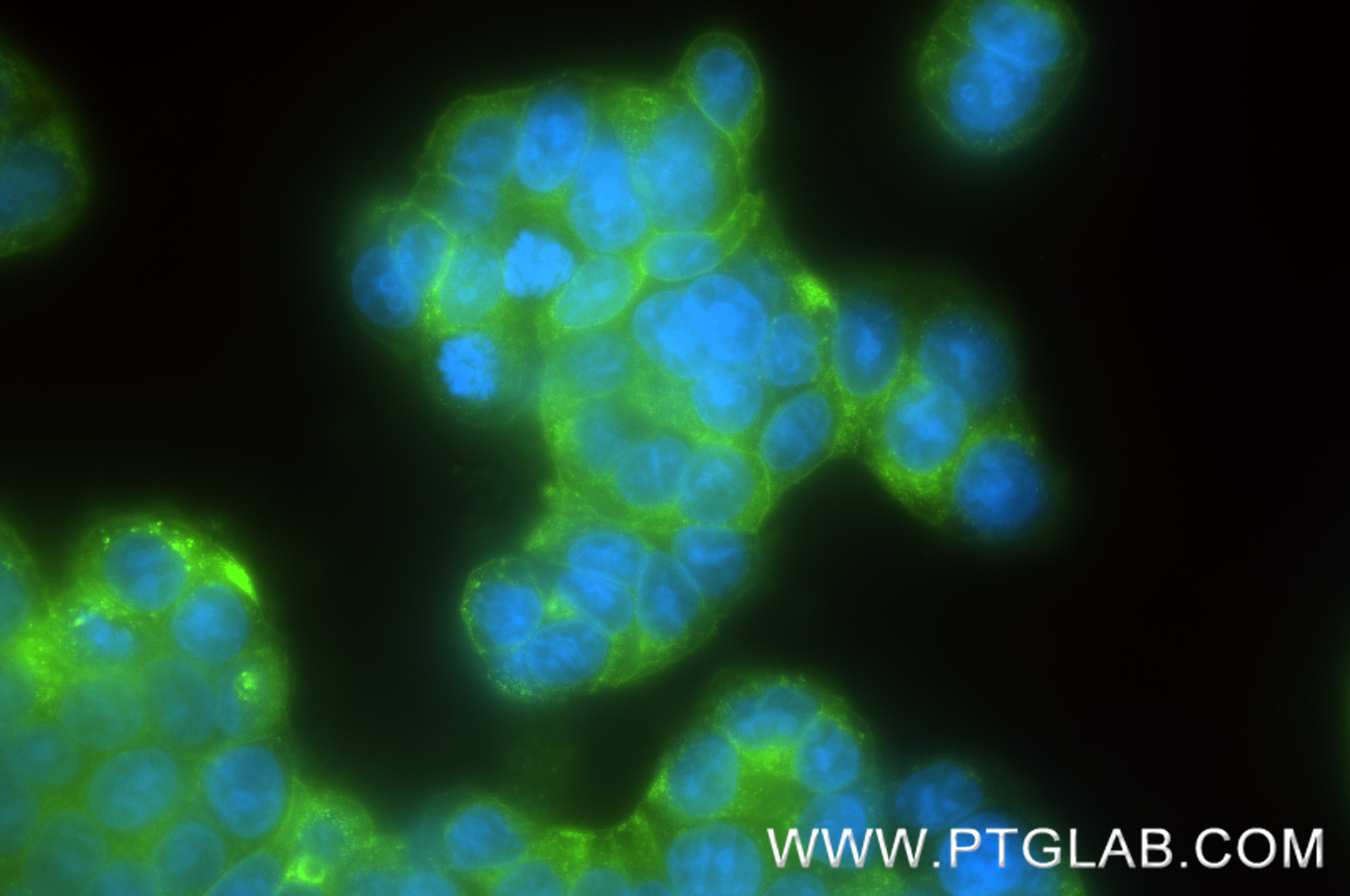 IF Staining of HT-29 using 83524-3-RR Immunofluorescence (IF) / fluorescent staining of HT-29 cells using CEACAM1/3/6 (CD66a/c/d) Recombinant monoclonal ant (83524-3-RR)