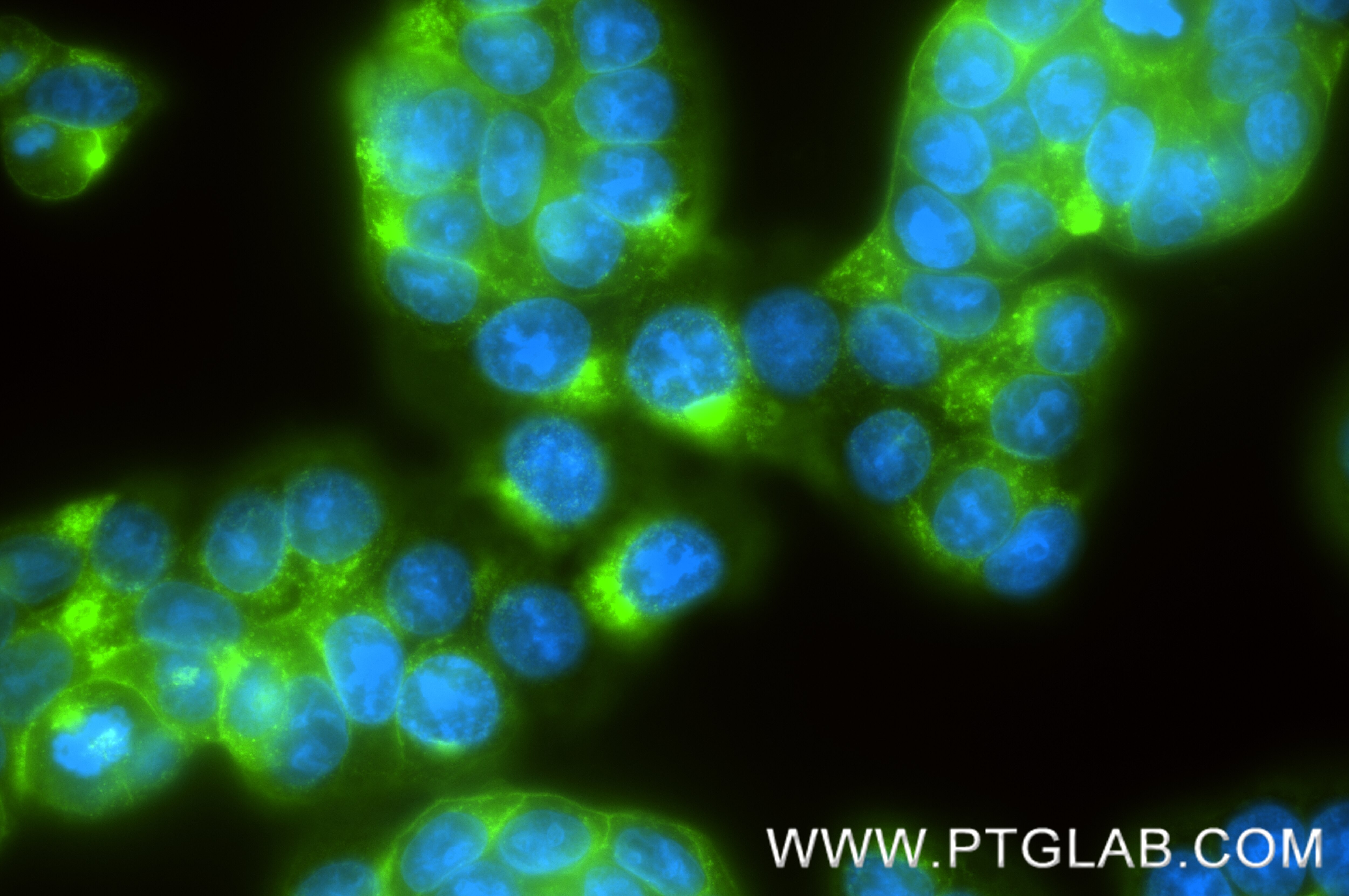 Immunofluorescence (IF) / fluorescent staining of HT-29 cells using CEACAM1/CD66a Recombinant monoclonal antibody (83524-8-RR)