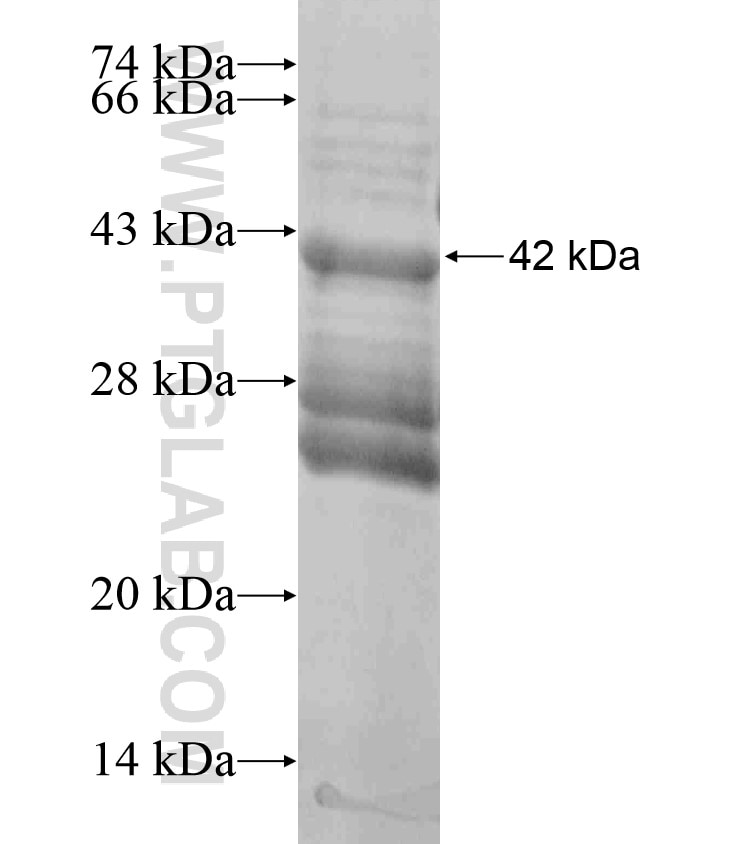 CEACAM1 fusion protein Ag17522 SDS-PAGE