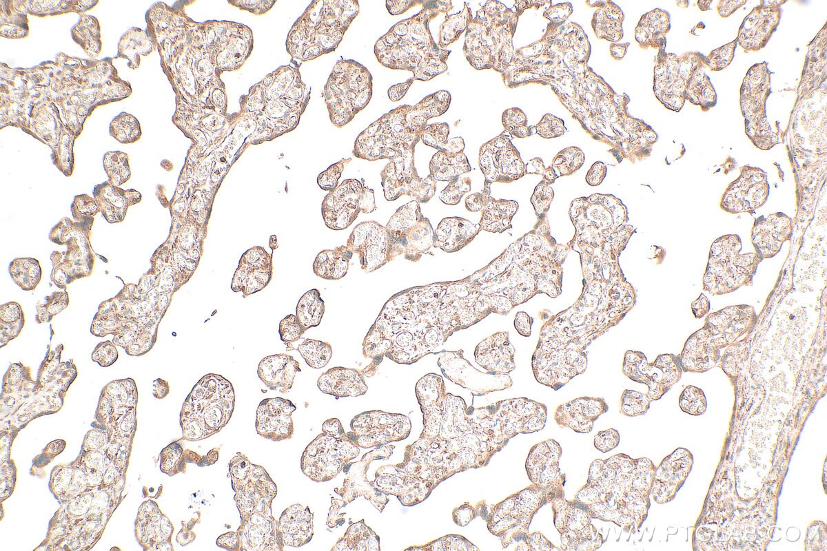 IHC staining of human placenta using 32196-1-AP (same clone as 32196-1-PBS) Immunohistochemistry (IHC) staining of human placenta tissue using CEACAM16 Polyclonal antibody (32196-1-AP)