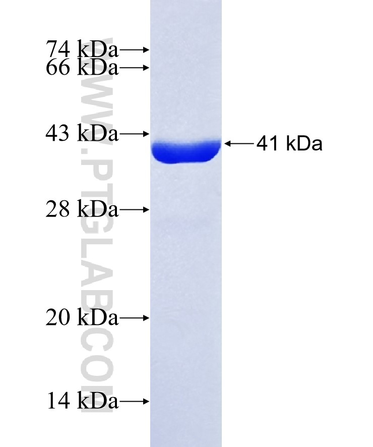 CEACAM16 fusion protein Ag37542 SDS-PAGE