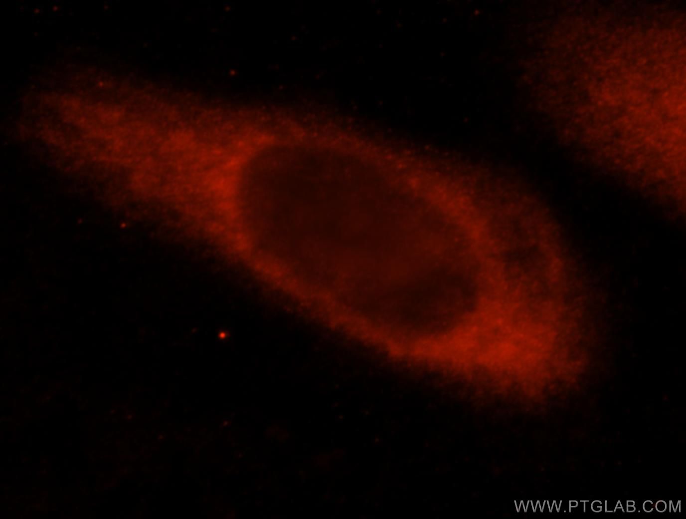 Immunofluorescence (IF) / fluorescent staining of HeLa cells using CEACAM21 Polyclonal antibody (17209-1-AP)