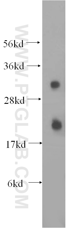 Western Blot (WB) analysis of HeLa cells using CEACAM21 Polyclonal antibody (17209-1-AP)