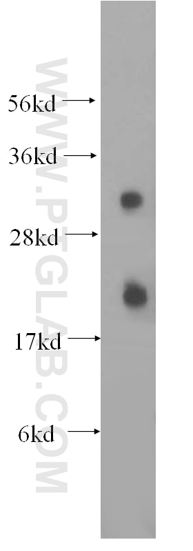 WB analysis of HeLa using 17209-1-AP