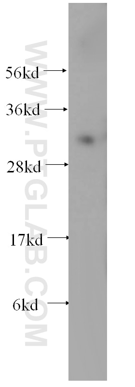 Western Blot (WB) analysis of mouse liver tissue using CEACAM21 Polyclonal antibody (17209-1-AP)