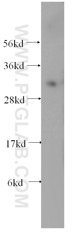 WB analysis of mouse liver using 17209-1-AP