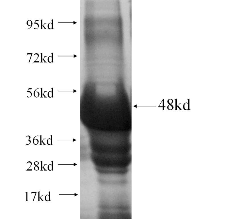 CEACAM21 fusion protein Ag10992 SDS-PAGE