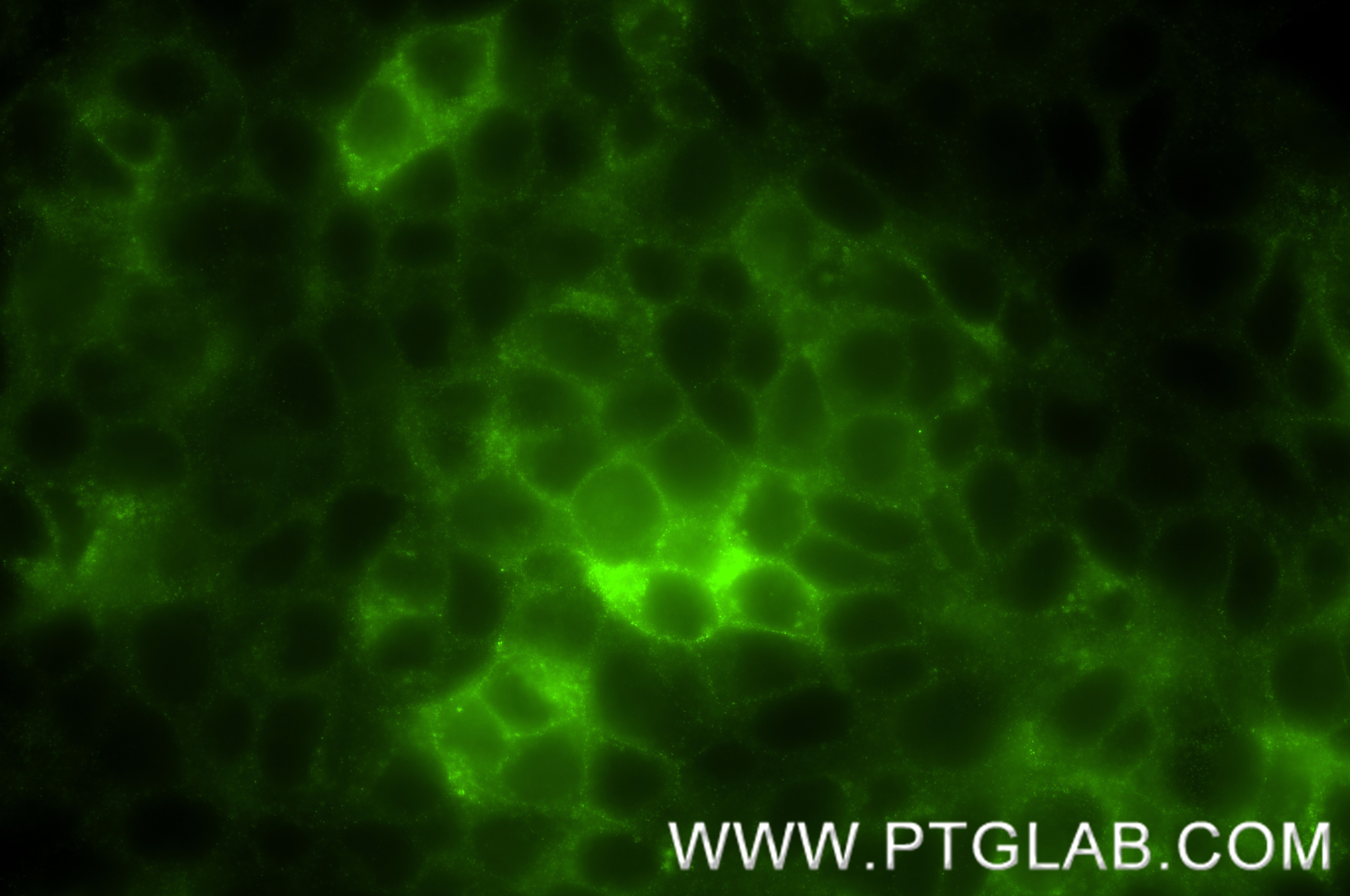Immunofluorescence (IF) / fluorescent staining of HT-29 cells using CEACAM6/CD66c Recombinant antibody (84982-1-RR)