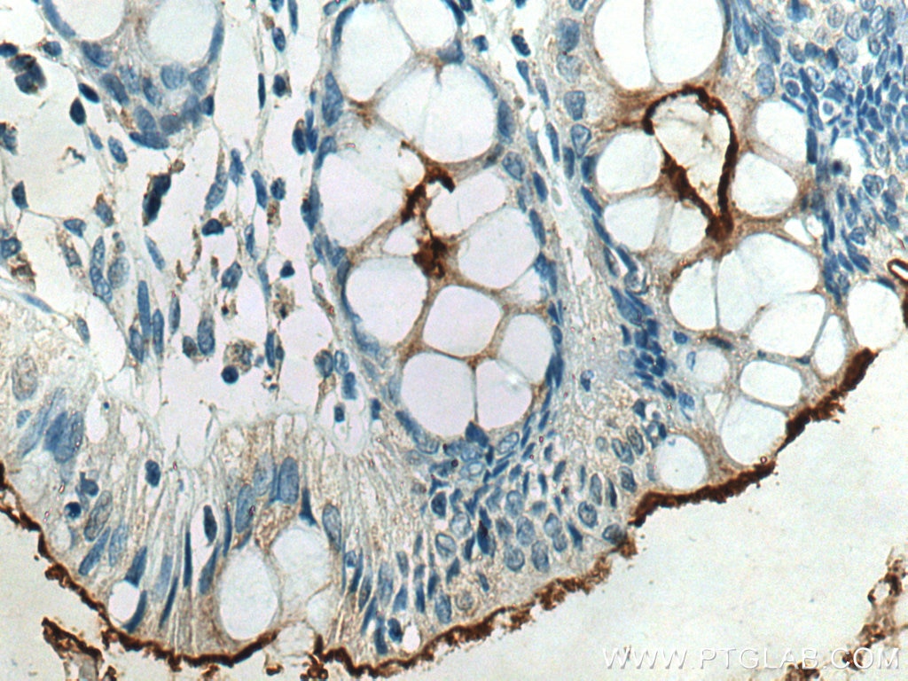 Immunohistochemistry (IHC) staining of human colon tissue using CEACAM7 Polyclonal antibody (24626-1-AP)