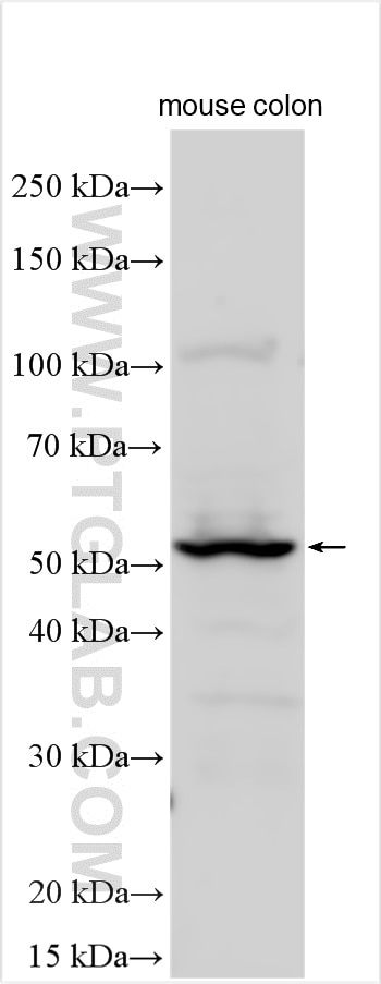 Western Blot (WB) analysis of mouse colon tissue using CEACAM7 Polyclonal antibody (24626-1-AP)