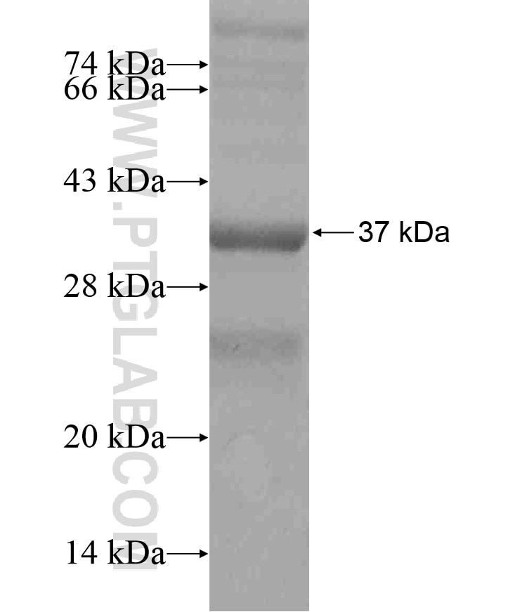 CEACAM7 fusion protein Ag18579 SDS-PAGE