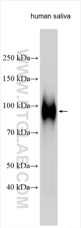 Western Blot (WB) analysis of various lysates using CEACAM8 Polyclonal antibody (30875-1-AP)