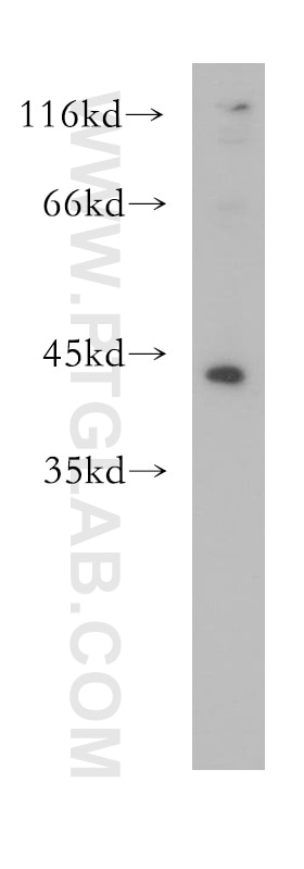 Western Blot (WB) analysis of human liver tissue using CEBPA Polyclonal antibody (18311-1-AP)