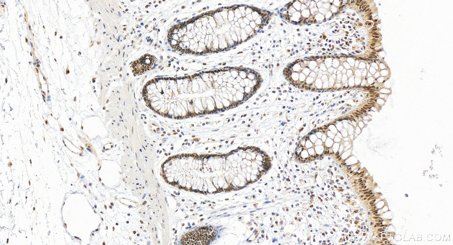 Immunohistochemistry (IHC) staining of human colon tissue using CEBP Alpha/CEBPA Polyclonal antibody (29388-1-AP)