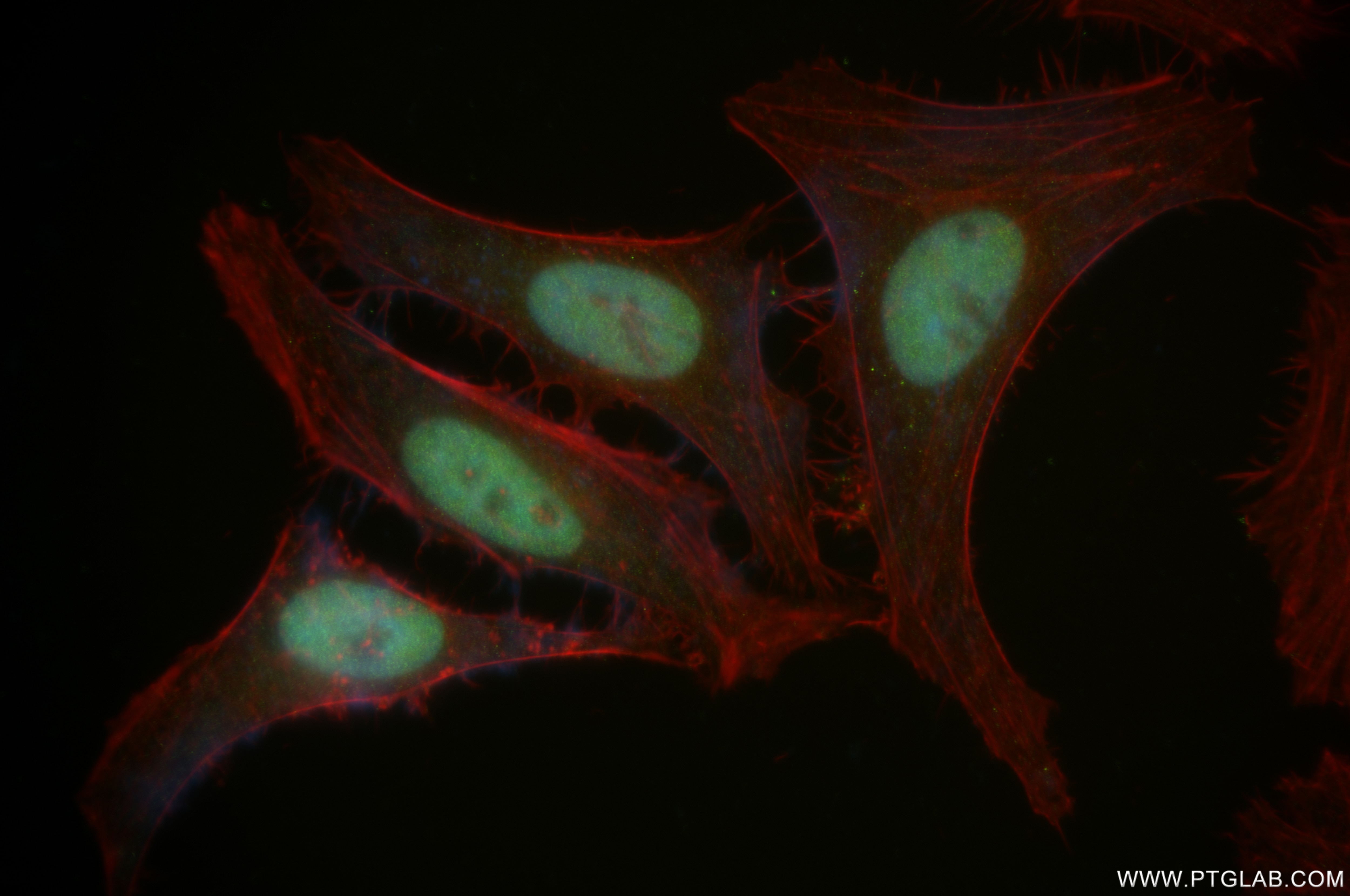 Immunofluorescence (IF) / fluorescent staining of HeLa cells using CEBP Alpha/CEBPA Recombinant antibody (84668-4-RR)