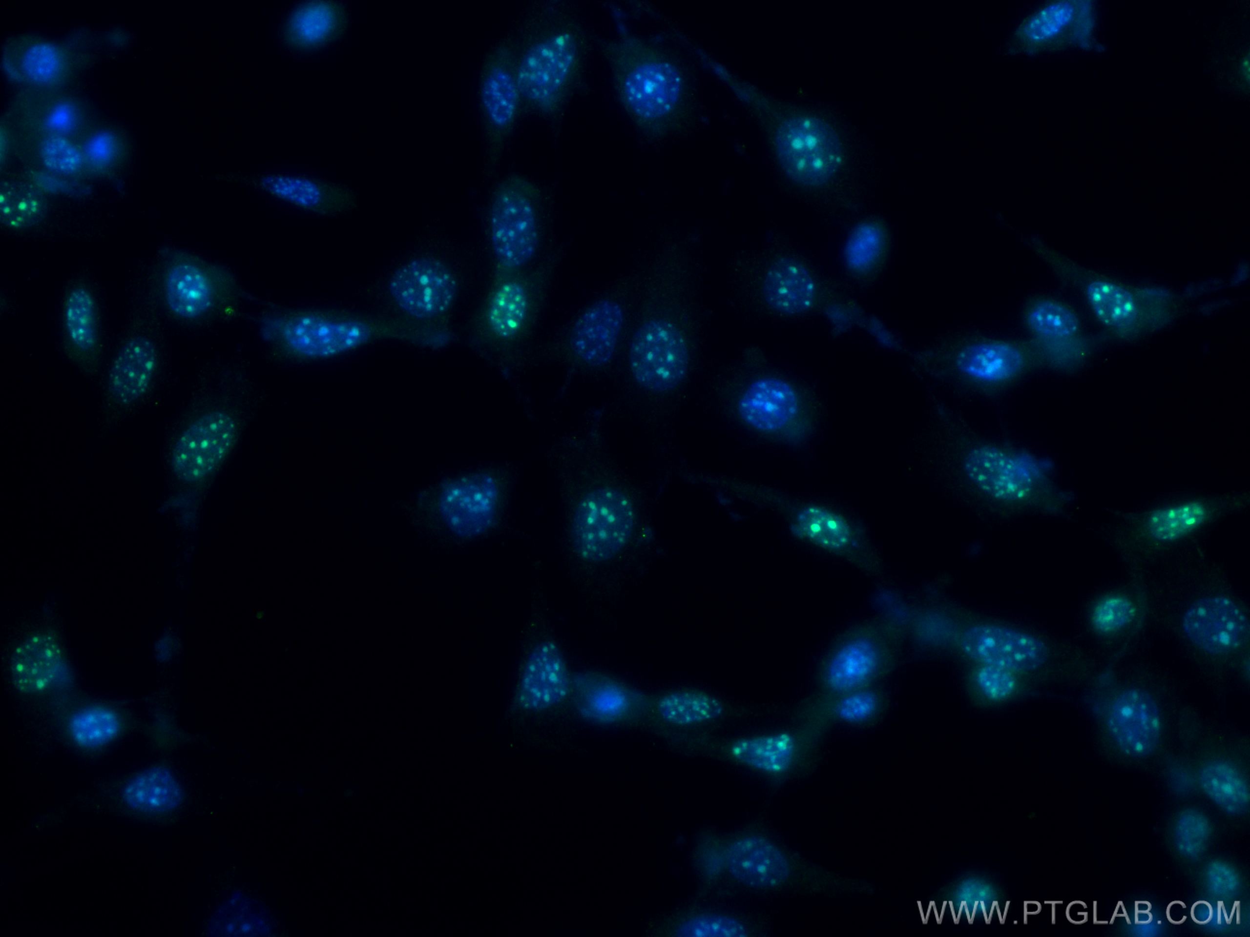 Immunofluorescence (IF) / fluorescent staining of NIH/3T3 cells using CEBPB Polyclonal antibody (23431-1-AP)