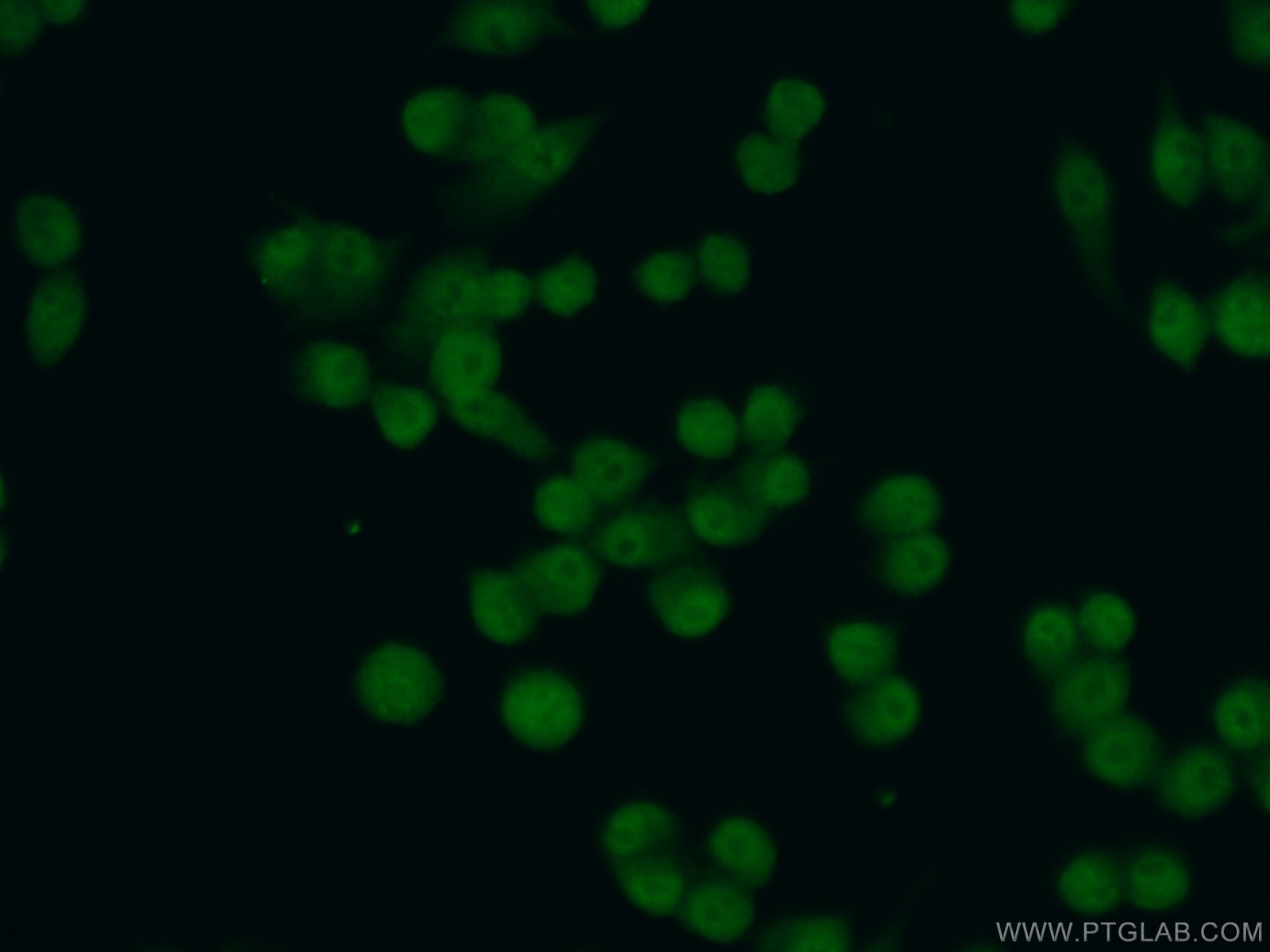 Immunofluorescence (IF) / fluorescent staining of RAW 264.7 cells using CEBPB Polyclonal antibody (23431-1-AP)