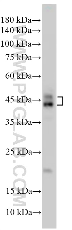 WB analysis using 23431-1-AP Western Blot (WB) analysis of various lysates using CEBPB Polyclonal antibody (23431-1-AP)