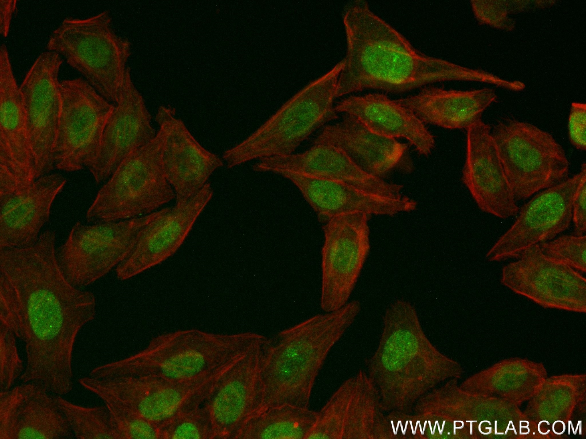 Immunofluorescence (IF) / fluorescent staining of HepG2 cells using CEBPB Recombinant antibody (83791-6-RR)