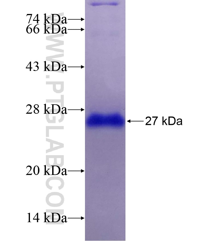 CEBPB fusion protein Ag28492 SDS-PAGE